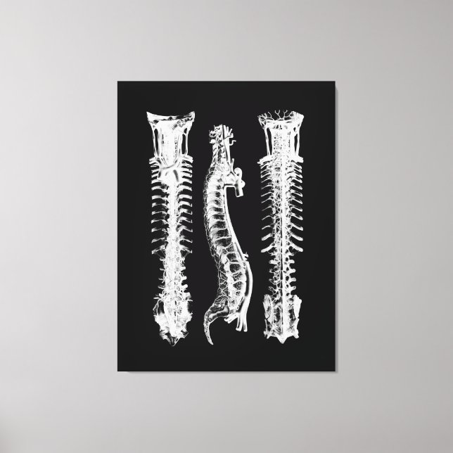 Anatomie der menschlichen Wirbelsäule Große Leinwa Leinwanddruck (Vorderseite)
