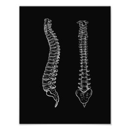 Anatomische Wirbelsäule, schwarz-weiß Fotodruck