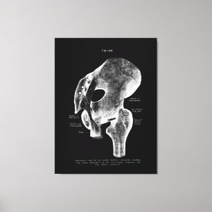 Angesagte gemeinsame Anatomie Medical Large Leinwa Leinwanddruck