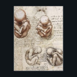 Ansichten eines Fetus in Womb.jpg von Leonardo Vin Postkarte<br><div class="desc">Diese Skizze und Studie aus der HochRenaissance mit dem Titel "Views of a Fetus in the Womb.jpg" wurde von Leonardo da Vinci mit der Kreide gemacht, Tinte auf Papiertechnik. Leonardo war und ist vor allem als Maler bekannt. Unter seinen Werken ist die Mona Lisa das berühmteste und parodiöseste Portrait und...</div>