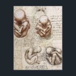 Ansichten eines Fetus in Womb.jpg von Leonardo Vin Postkarte<br><div class="desc">Diese Skizze und Studie aus der HochRenaissance mit dem Titel "Views of a Fetus in the Womb.jpg" wurde von Leonardo da Vinci mit der Kreide gemacht, Tinte auf Papiertechnik. Leonardo war und ist vor allem als Maler bekannt. Unter seinen Werken ist die Mona Lisa das berühmteste und parodiöseste Portrait und...</div>