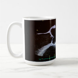 Aoraler Doppler-Echokardiogramm-Becher Kaffeetasse
