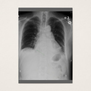 ATC cardiaque de ~ de chirurgie