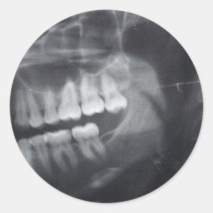 Autocollants de mâchoire