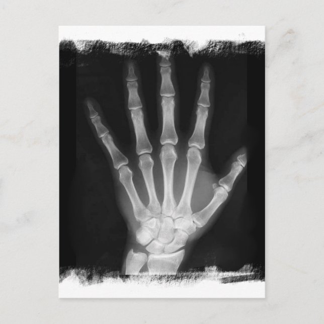 B&W Röntgen Skeleton Hand Postkarte (Vorderseite)