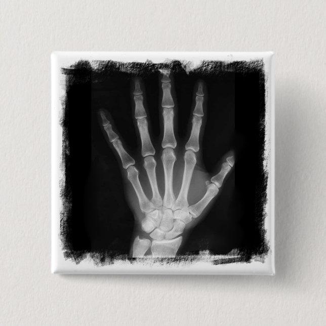 B&W Röntgenstrahl-Skelett-Hand Button (Vorderseite)