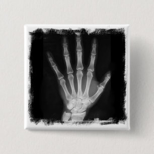 B&W Röntgenstrahl-Skelett-Hand Button