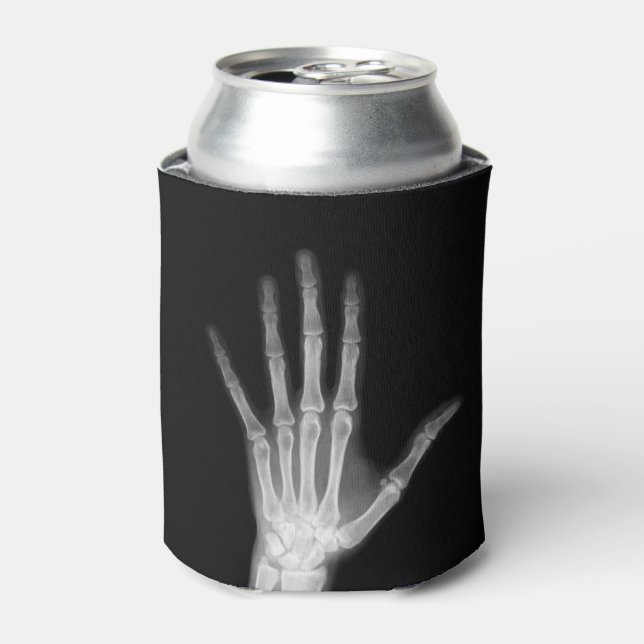 B&W X-Ray Arm Skelettknochen Dosenkühler (Kanne Vorderseite)