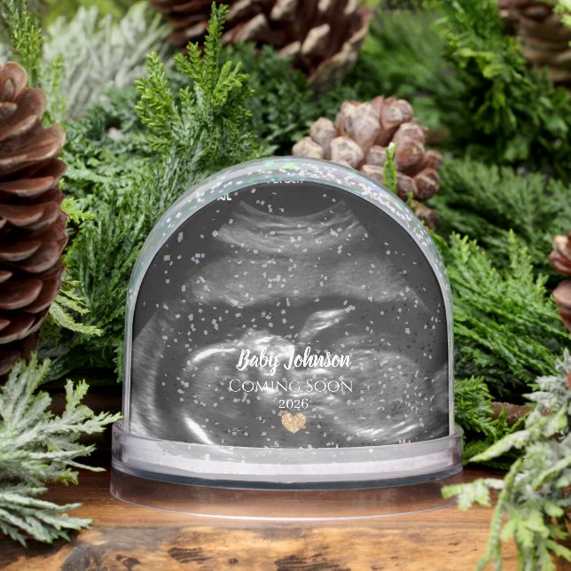 Baby Coming Bald Sonogram Gold-Herz Schneekugeln (Winter)