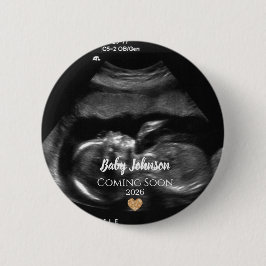 Baby Coming Soon Ultrasound Gold heart  Button