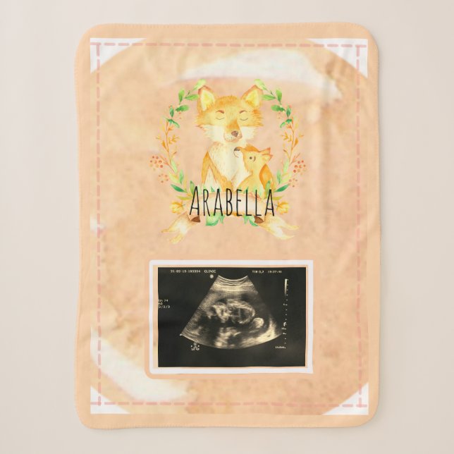 Baby Fox Custom Ultrasound Picture Sherpa Blanket Sherpadecke (Vorderseite)