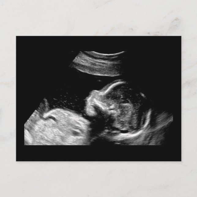 Baby Postkarte (Vorderseite)