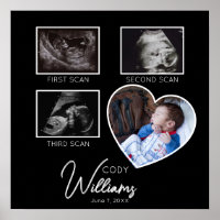 Baby Scan Foto Sonogramm Baby Keeper