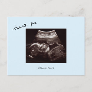Baby-Shower-Ultraschall Süßes Eisblaues Danke Postkarte