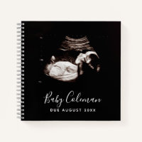 Baby Sonogram Personalisiert Memory Prenancy Book