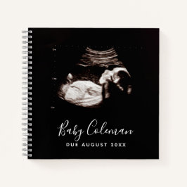Baby Sonogram Personalisiert Memory Prenancy Book Notizbuch