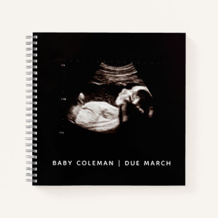 Baby Sonogram Personalisiert Memory Prenancy Book Notizbuch