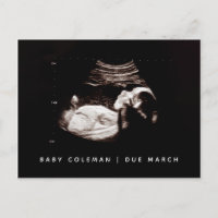 Baby Sonogram Pregnancy Ankündigung Foto