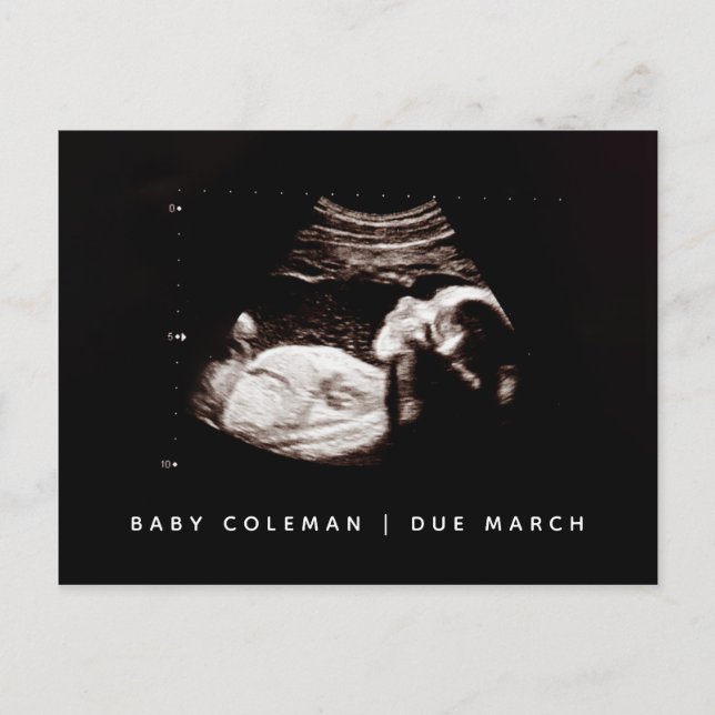 Baby Sonogram Pregnancy Ankündigung Foto Postkarte (Vorderseite)