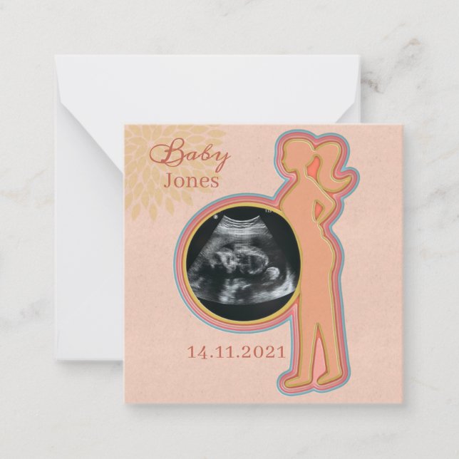Baby Ultrasound Keepake Mitteilungskarte (Vorderseite)