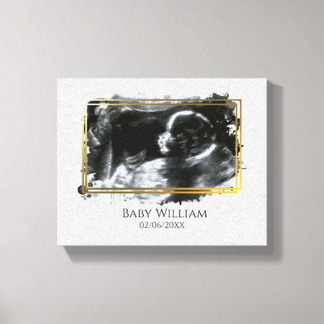 Baby Ultrasound Sonogram Picture erwartend Leinwanddruck (Vorderseite)