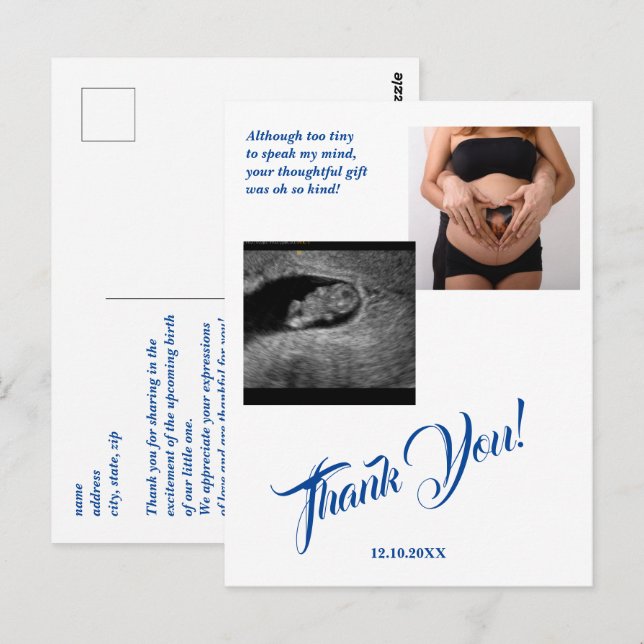 Babydusche Ultrasound Girl Pink Vielen Dank. Postkarte (Vorne/Hinten)