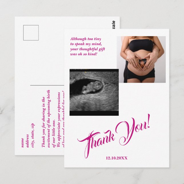 Babydusche Ultrasound Girl Pink Vielen Dank. Postkarte (Vorne/Hinten)