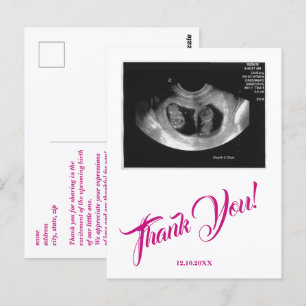 Babydusche Ultrasound Girl Pink Vielen Dank. Postkarte