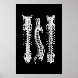 Backbone Anatomy Wall Decoder Medical Art Poster