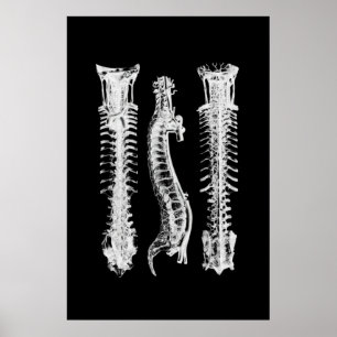 Backbone Anatomy Wall Decoder Medical Art Poster