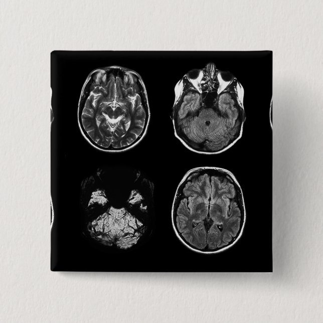 Badge Carré 5 Cm Analyse IRM du cerveau (Devant)