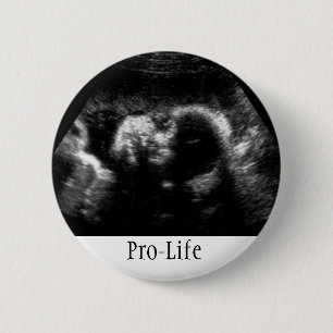 Badge Rond 5 Cm Contre l'avortement et l'euthanasie