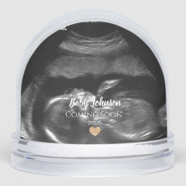 Bébé à venir bientôt échographie Cœur en or 