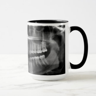 Becher Panorama Röntgenaufnahme Tasse