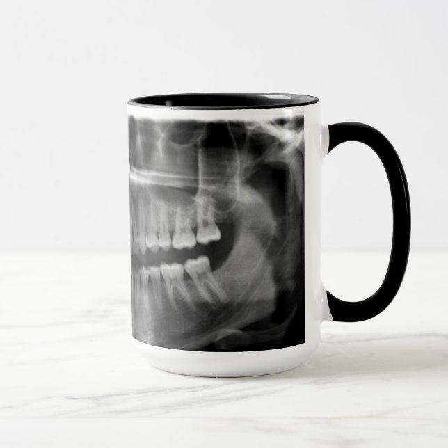 Becher Röntgenaufnahme Röntgenologie Tasse (Rechts)