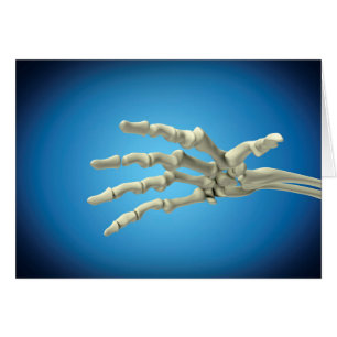 Begriffsbild der Knochen in menschlicher Hand 1
