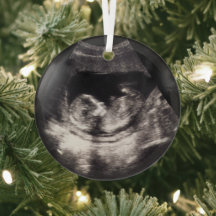 Benutzerdefiniertes Baby-Ultraschall-Schwangerscha