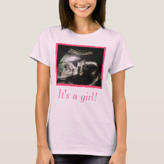 Besonders anzufertigen Ultraschall-MutterschaftsT T-Shirt