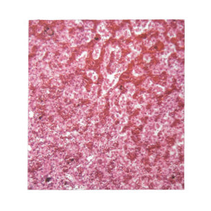 Bloc-note Cellules de foie humaines avec le cancer