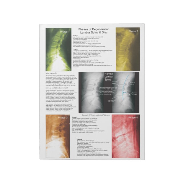 Bloc-note Éteindre La Dégénérescence De La Moelle De Lumière (Tourné)