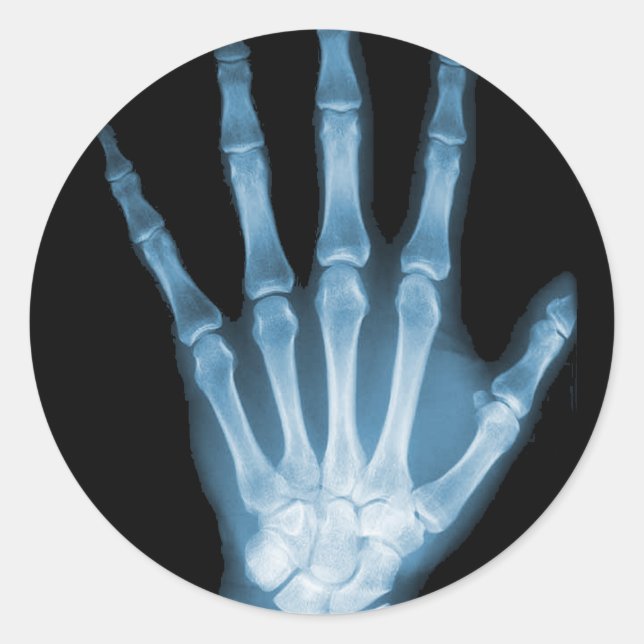 Blue Röntgen Skeleton Hand Runder Aufkleber (Vorderseite)