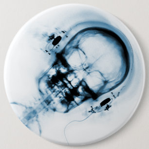 Blue X-Ray Vision Music Skeleton Skull Button