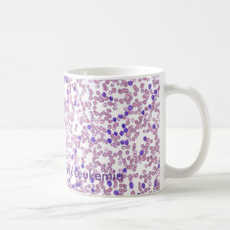 Blut-Muster der Kaffeetasse-CLL Kaffeetasse