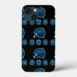 Brain Mri scan Case-Mate iPhone Hülle