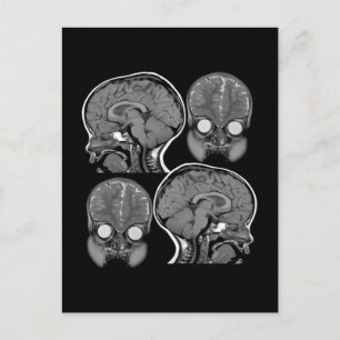 BRAINS! (MRI) POSTKARTE