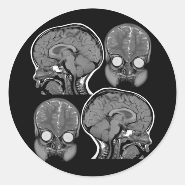 BRAINS! (MRI) RUNDER AUFKLEBER (Vorderseite)