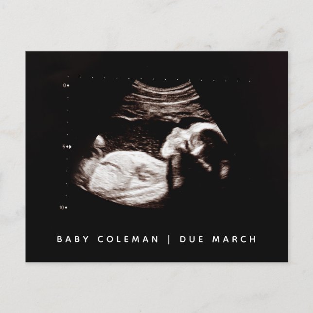 Budget Pregnancy Baby Sonogram Ultrasound Foto Flyer (Vorne)