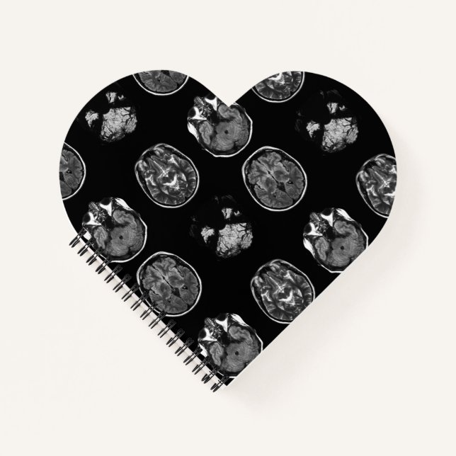 Carnet Analyse IRM du cerveau (Devant)