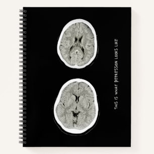 Carnet CT Scan_CTFOD_ Voici à quoi ressemble la dépressio
