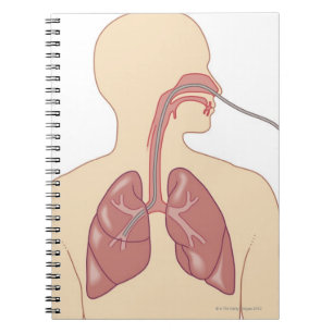Carnet Route du Bronchoscope